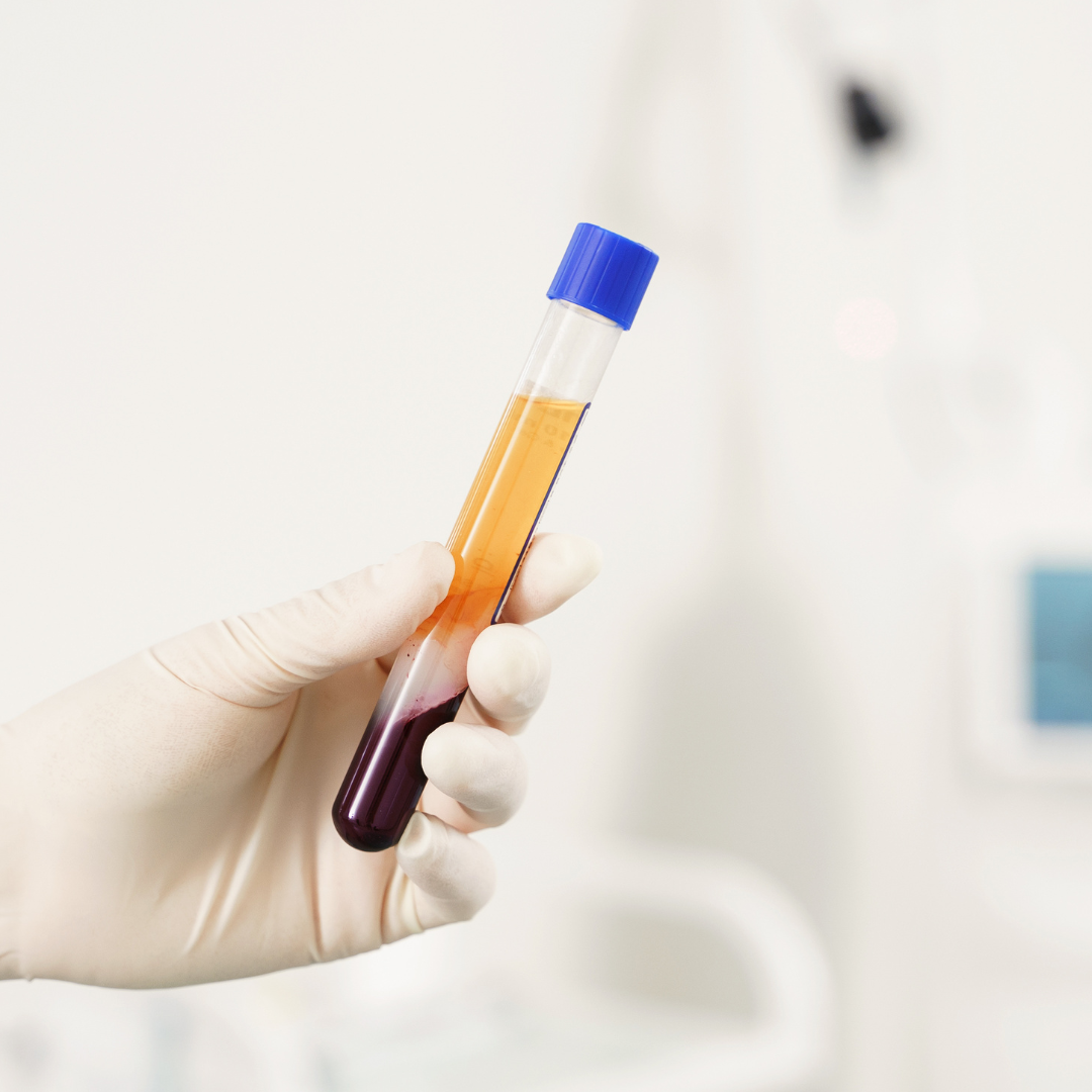 Dermapen con Regen PRP