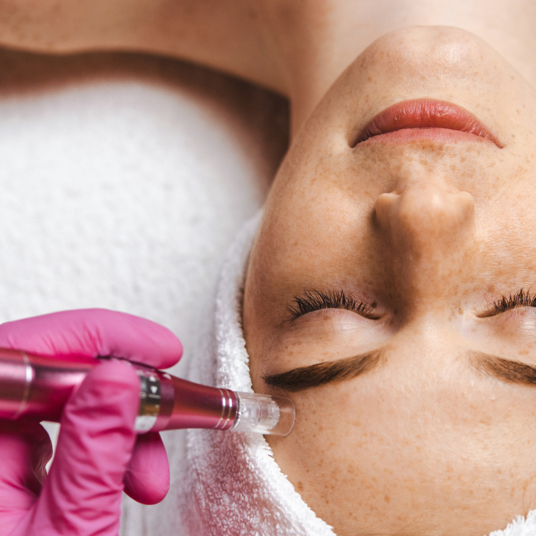 Dermapen con Regen PRP