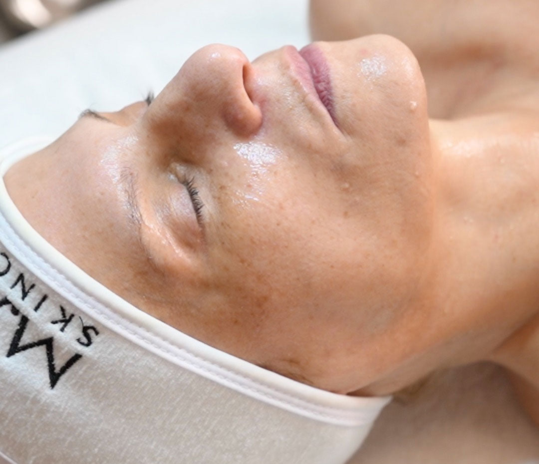 Tratamiento Renovador